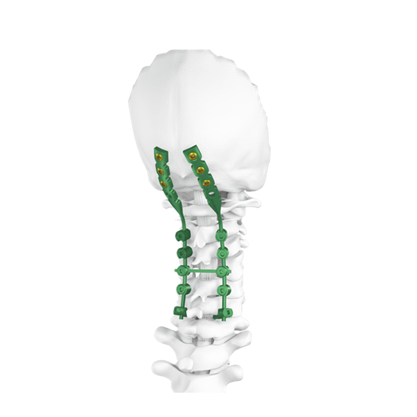 Sistema occipital do parafuso da espinha do cervical posterior